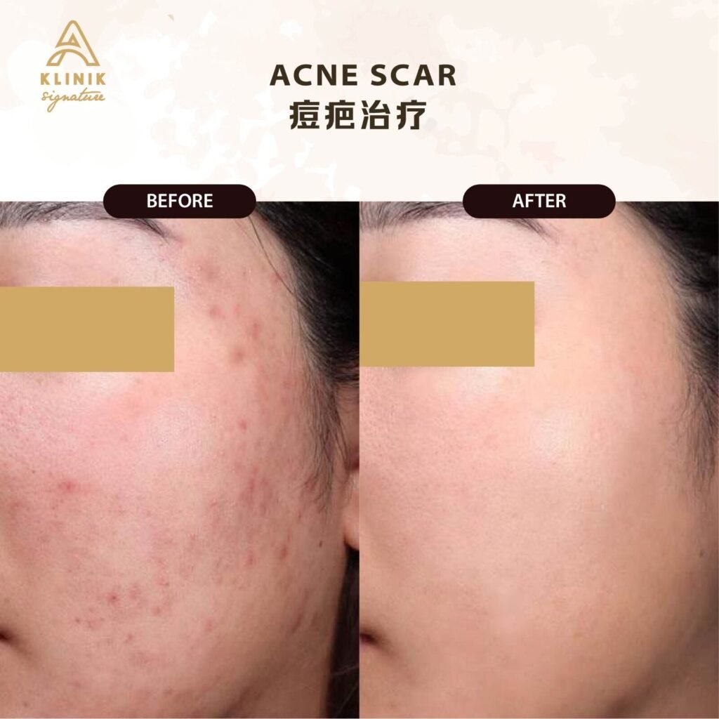 SCARS 8