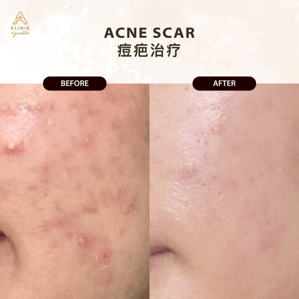 SCARS 9
